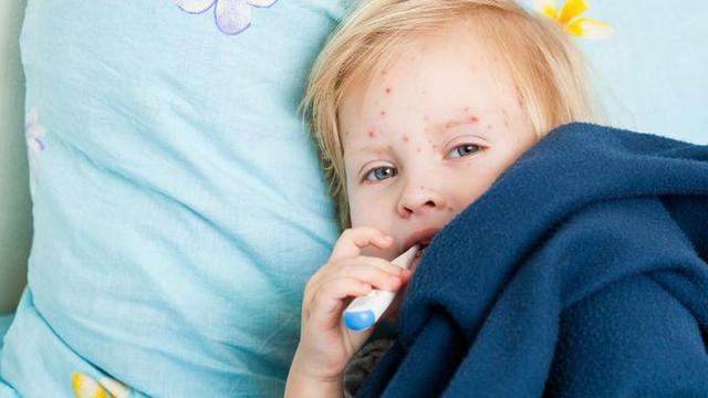 Tangani Campak, Jabar Laksanakan Respon Imunisasi